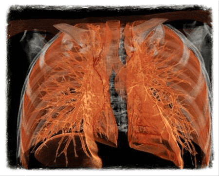 КТ органов грудной клетки и средостения